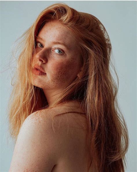 Pin On Beautiful Frecklesgingers