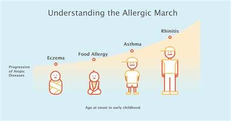 However, some continue to be allergic to milk until they are. Science Shows Babies With Cow's Milk Allergy Have A Higher Risk Of Exhibiting More Allergies ...