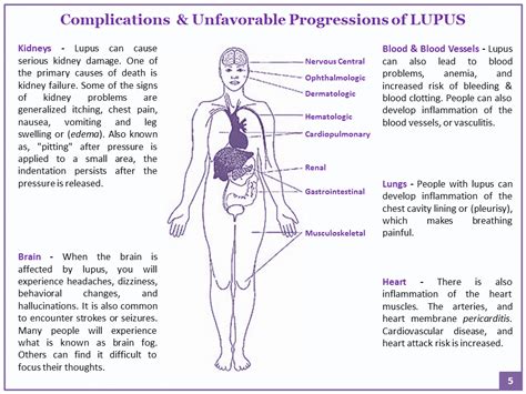 Complications Of Lupus Systemic Autoimmune Disease Lupus Autoimmune