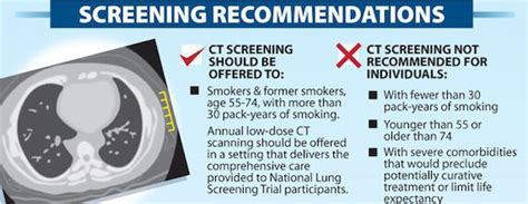 New Usa Lung Cancer Screening Guidelines