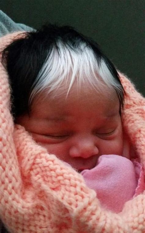 Doctors Finally Realize Why Baby Was Born With Head Full Of Grey Hair
