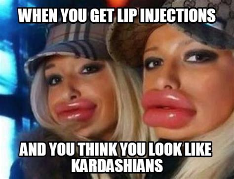 Lip Injections Gone Wrong Plastic Surgery Photoshop Fail Duck Face