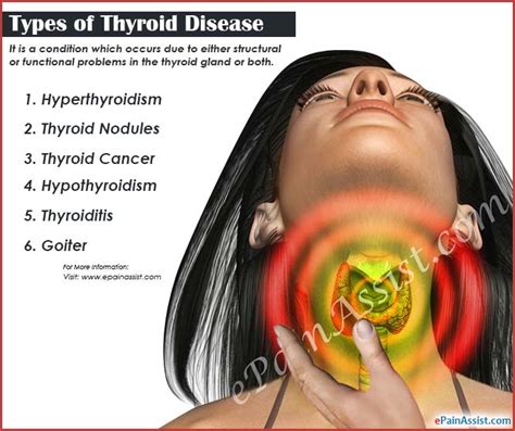 Thyroid Disease Types Causes Symptoms Treatment Prognosis
