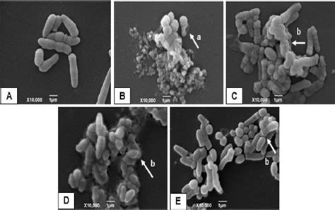 Sem Images Of C Xerosis Ial 105 A Untreated Bacterial Cells B