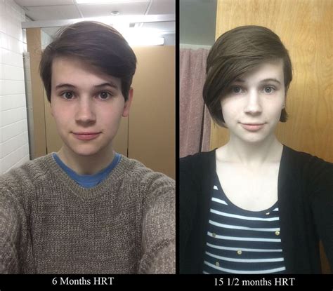Admin december 29, 2017 hair loss no comments. Pin on MTF Before and After