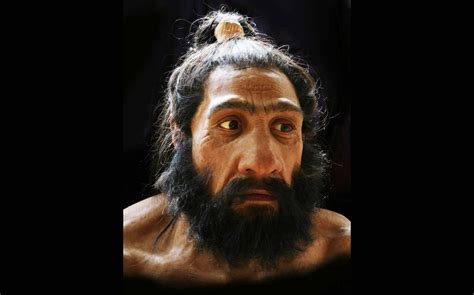 Crohns And Sickle Cell Anaemia Evolved To Protect Neanderthals From