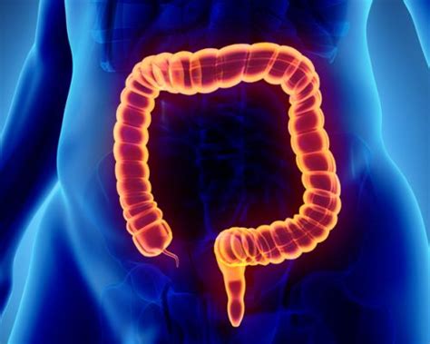 Microscopic Colitis Types Causes Symptoms And Diet