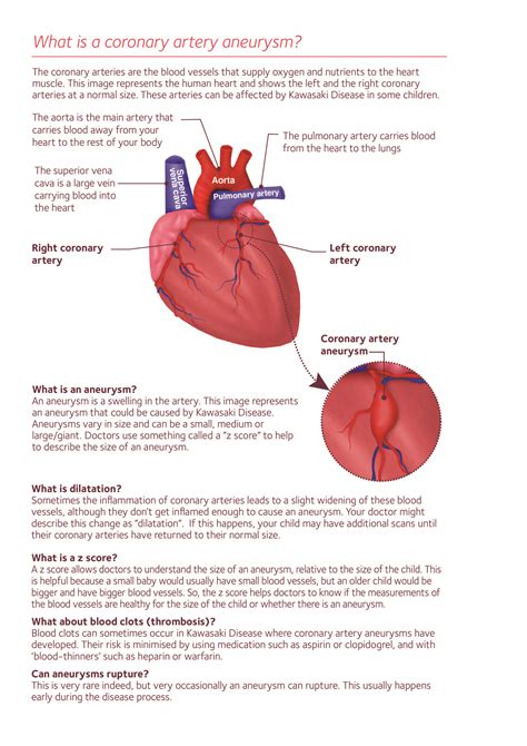 What is a coronary artery aneurysm - portrait-01 - Societi