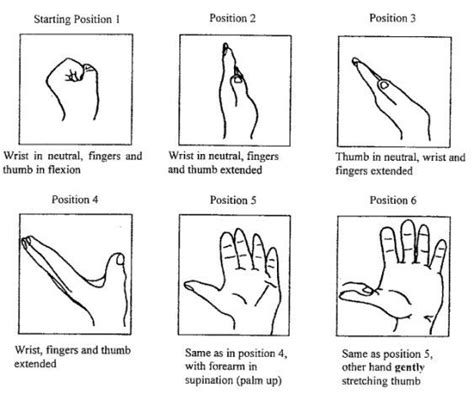 Longitudinal gliding of the median nerve in the carpal tunnel: Nerve glide exercises that may prevent carpal tunnel ...