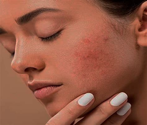 Siapapun pasti ingin memiliki kulit wajah yang sehat, segar, dan cerah. cara penjagaan muka orang korea , tips penjagaan muka ...
