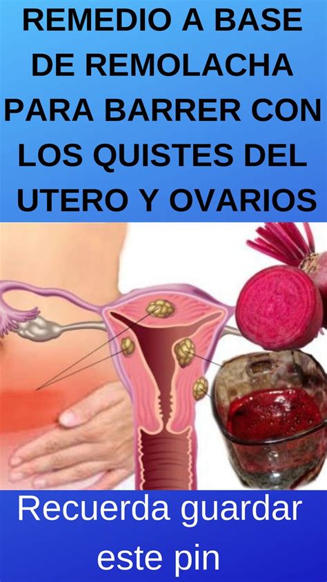 Remedio A Base De Remolacha Para Barrer Con Los Quistes Del Utero Y Ovarios Remedios Remolacha