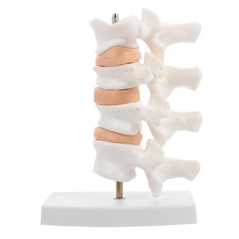 Pc Human Osteoporosis Model PVC Spine Model Vertebra Pathology Model For Display Precision