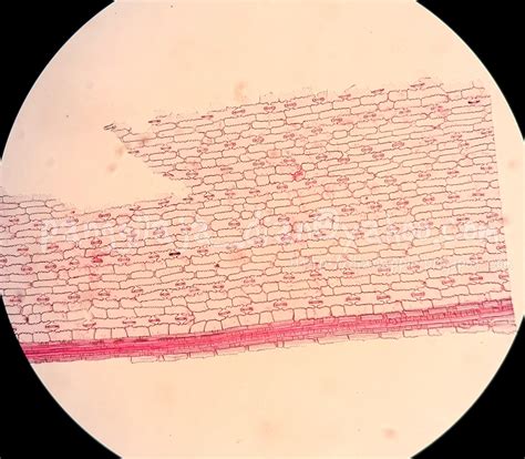Beberapa tumbuhan memiliki trikoma dengan pangkal yang kuat seperti pada daun jagung (zea mays) dan daun kumis kucing (orthosiphon stamineus). PooR pRinZa aPpLe: Stomata Halter Daun Zea mays