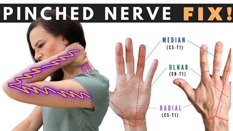 How To Fix A Pinched Nerve In The Neck Dr Jon Saunders Youtube