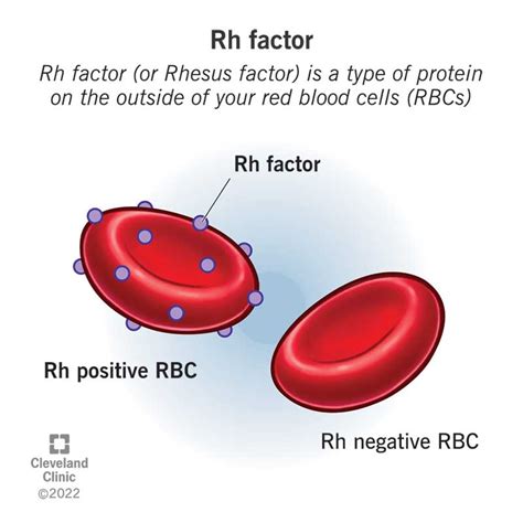 Rhesus Rh Factor Incompatibility Complications And Pregnancy