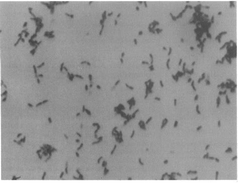 Gram Stain Of Propionibacterium Acnes Showing Variably Staining Gram