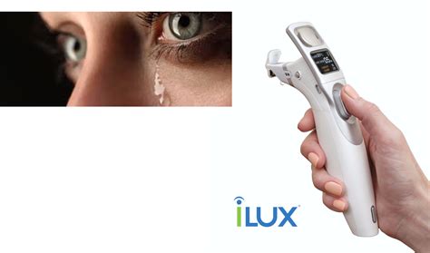 Tear Film Innovations - iLux® Dry Eye Treatment System - DDSTUDIODDSTUDIO