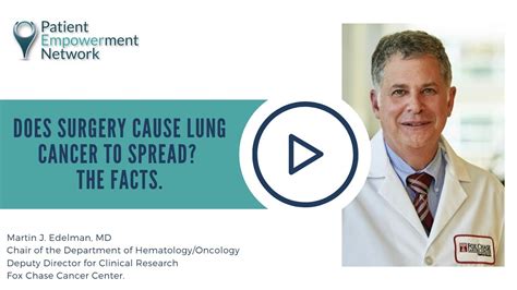 After testicular cancer has been diagnosed, tests are done to find out if cancer cells have spread it is important to know the stage in order to plan treatment. Does Surgery Cause Lung Cancer to Spread? The Facts. - YouTube