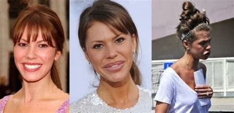 Nikki Cox Plastic Surgery Gone Wrong Before And After Breast Implants