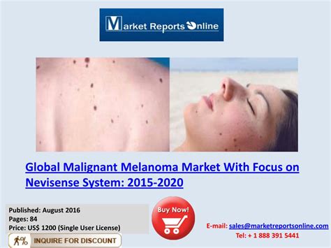 Ppt Worldwide Malignant Melanoma Market 2020 Forecast Research Report