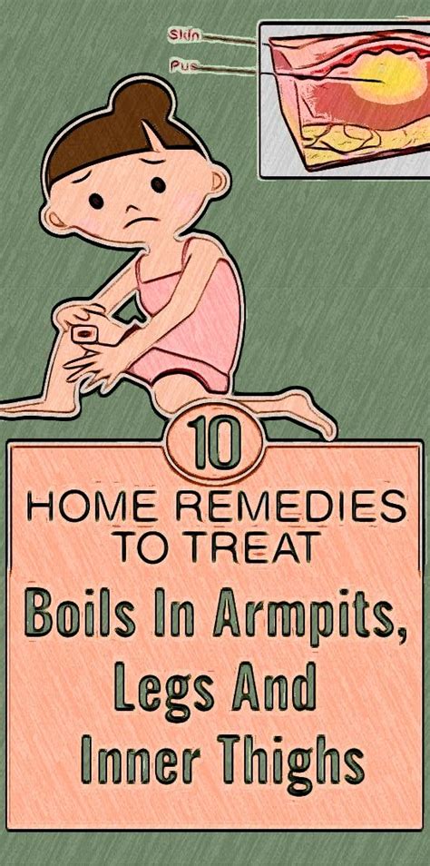 10 Quick Home Remedies To Cure Boils In Armpits Legs And Inner Thighs