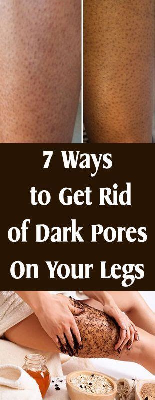 7 Ways To Get Rid Of Dark Pores On Your Legs7 Ways To Get Rid Of Dark