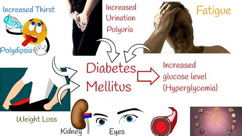 Diabetes Mellitus Symptoms Treatment And Long Term Risks Youtube