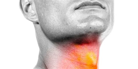 Kanker Kepala Dan Leher Waspada Kanker Di Hidung Sampai Tenggorokan