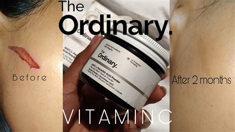 Formulated with the powerful combination of vitamin c and alpha arbutin, ascorbic acid + alpha arbutin 2% diminishes dark spots, evens skin tone and delivers a my skin did react to the ordinary vitamine c 30% suspension. THE ORDINARY 100% L-ASCORBIC ACID POWDER REVIEW AND HOW TO ...