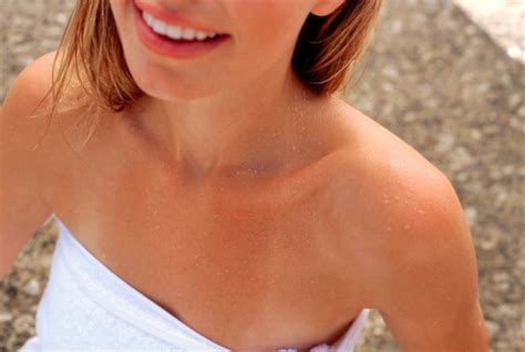 I thought i would take some time. How to Treat Sunburn