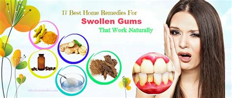 Home Remedy For Swollen Gums Homelooker