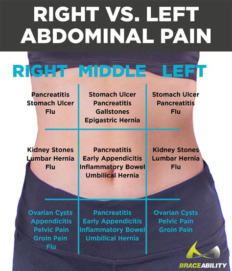 Graphic Displaying Location Of Common Abdominal Pain In Women