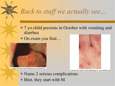 Ppt Papules Purpura Petechia And Other Pediatric Problems A Review