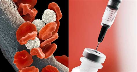 But if there are only a few cancer cells in a lymph node, it may look. Cancer Treatment Breakthrough: Scientists Have Found A ...