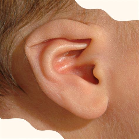 Ear Lidding Deformation Earwell