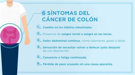 Prevencion Cancer De Colon Sintomas