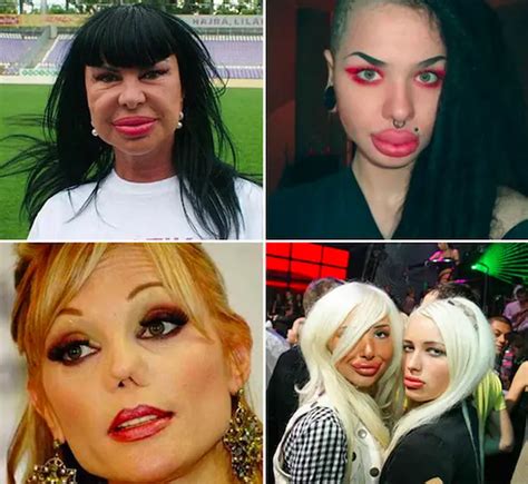These 21 Examples Of Plastic Surgery Gone Horribly Wrong Will Haunt