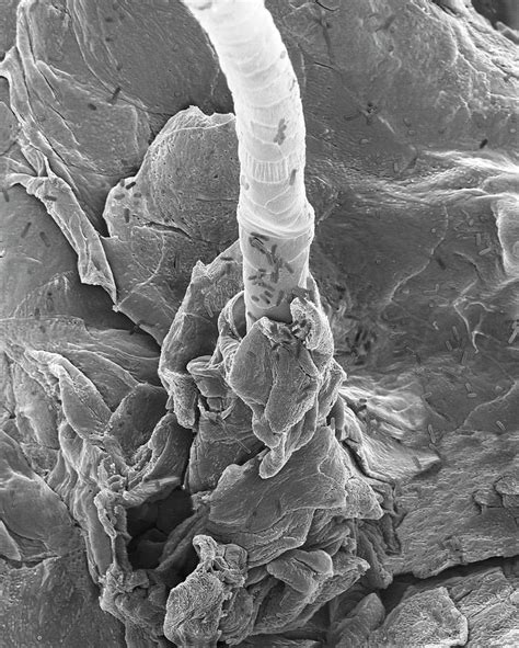 E Coli On Human Skin And Hair Follicle Photograph By Dennis Kunkel