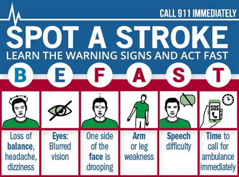 How To Recognize And Respond To A Warning Stroke Harvard Health