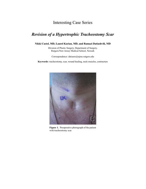 Tracheostomy Scar Revision