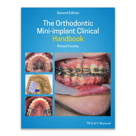 The Orthodontic Mini Implant Clinical Handbook Second Edition By Dr