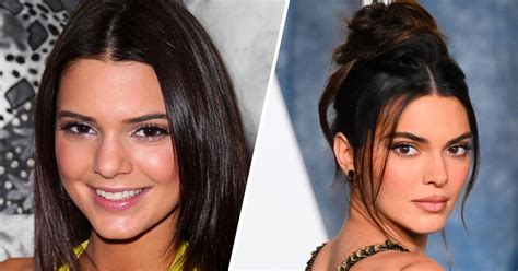 Kendall Jenner Before And After Beauty Evolution Elle Australia