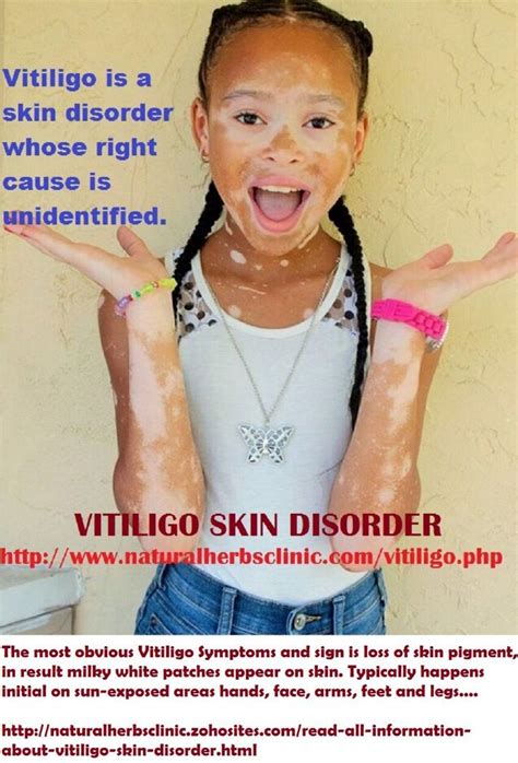 Vitiligo Magazines
