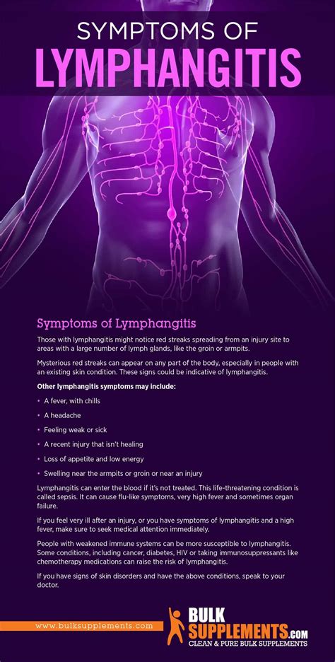 Lymphangitis Discover Quick Treatments And Healthy Supplements
