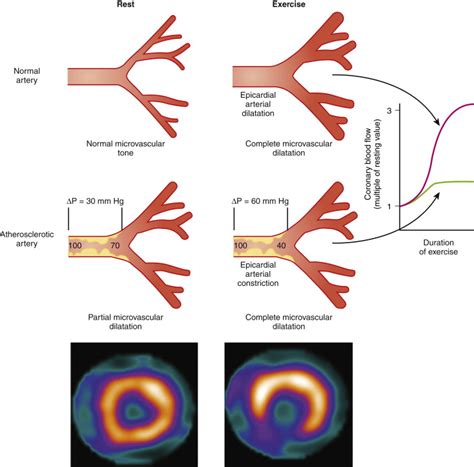 Radionuclide Imaging Cardiac Radiology Key