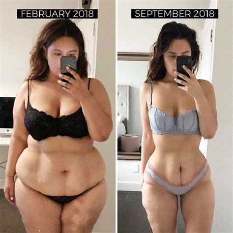 Womans Incredible Before And After Pictures Of Her 141 Pound Weight