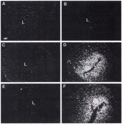 1 In Situ Hybridization Of Vegf Expression In The Rat Uterus And E Download Scientific