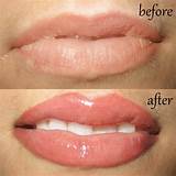 Permanent Makeup Lips