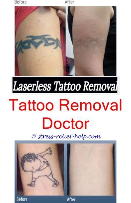 At our cheap essay writing service, you can be sure to get credible academic aid for a reasonable price, as the name of our website suggests. Tattoo removal best results.What is the average cost of a tattoo removal.Will tattoo remov ...