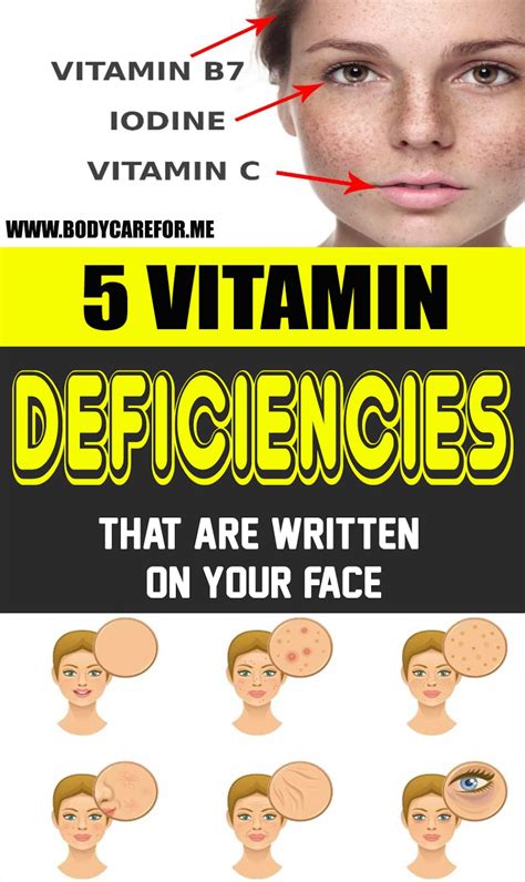 Vitamin Deficiency Signs That Show Up On Your Face